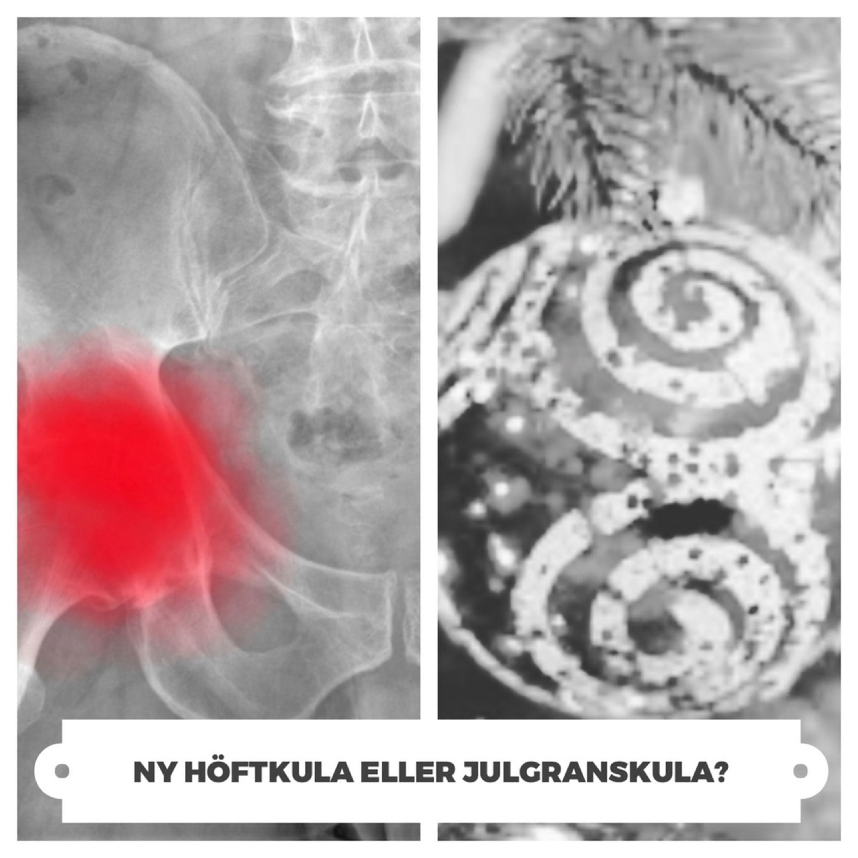 Dålig Mottagning