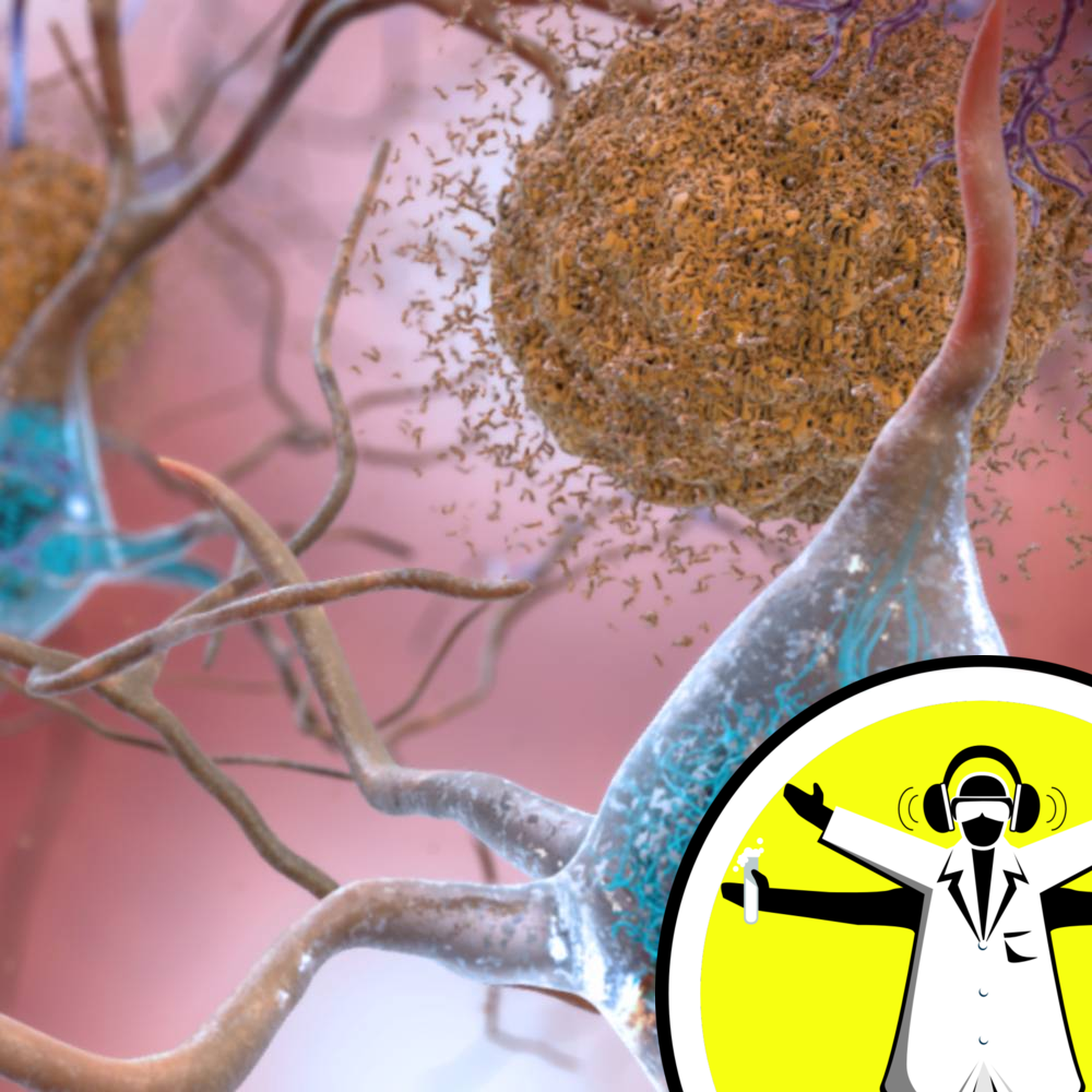Alzheimer's Disease: Facts and Fiction